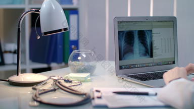 医生工作x光移动PC工作场所放射科医生检查x射线图片
